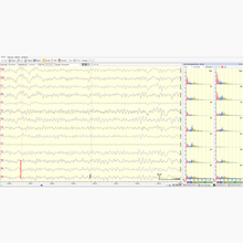 Load image into Gallery viewer, NeuroREC