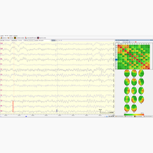 Load image into Gallery viewer, NeuroREC