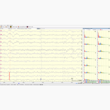 Load image into Gallery viewer, NeuroREC
