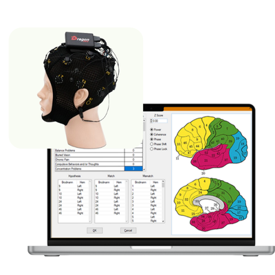 Neuroguide Software qEEG Kit DragonEEG + NeuroGuide™ – BrainBit