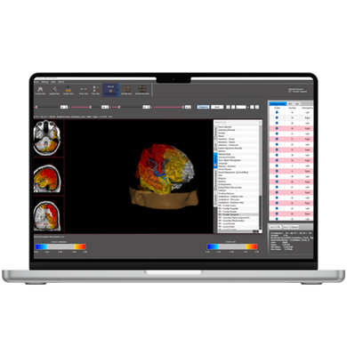 Software – BrainBit