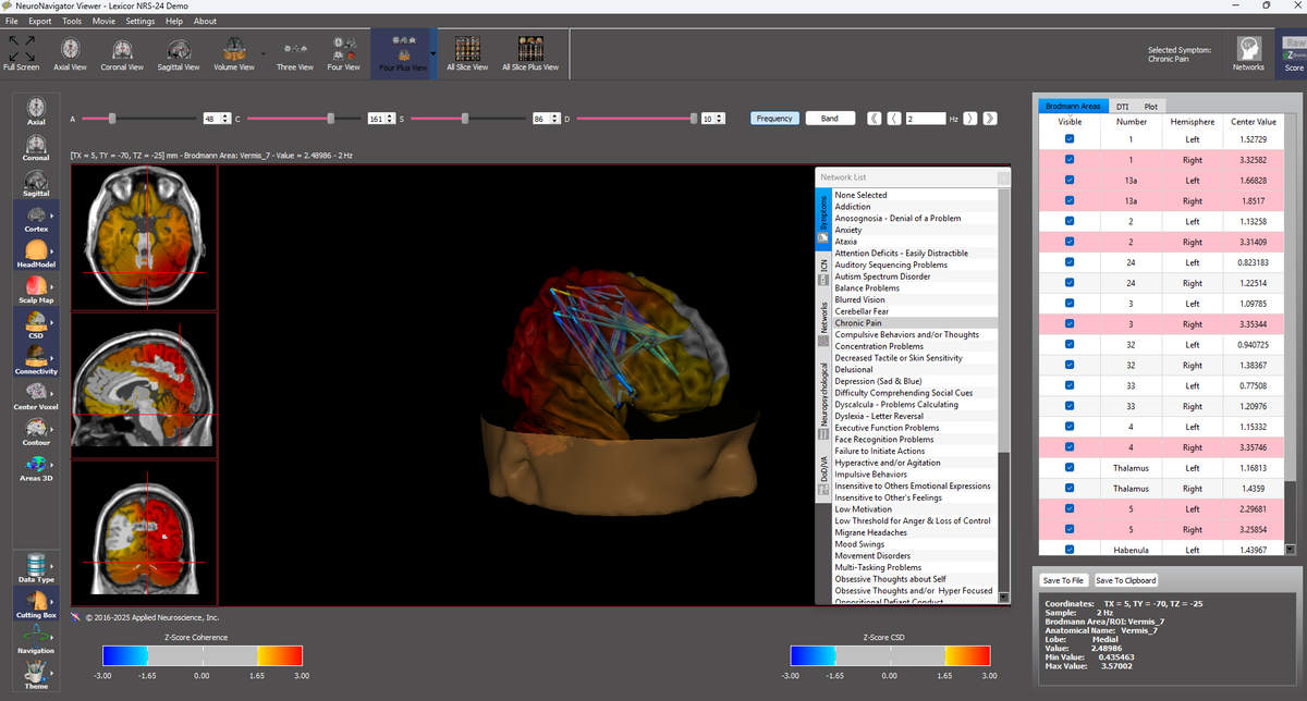 NeuroGuide™ – BrainBit