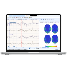Load image into Gallery viewer, NeuroREC
