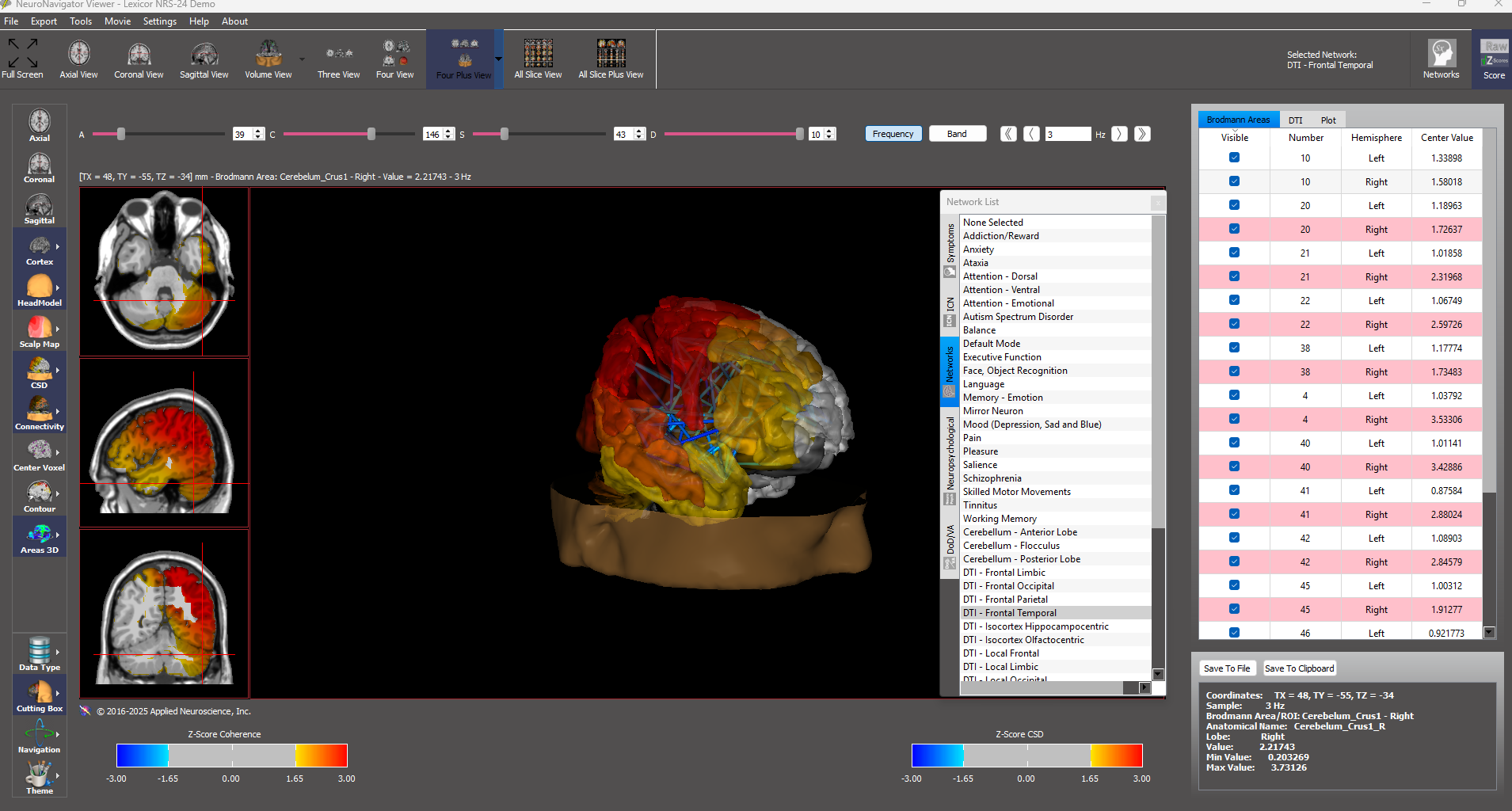 Neuroguide Eeg Buy DragonEEG + NeuroGuide™ | Professional qEEG Bundle – BrainBit