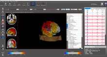 Load image into Gallery viewer, NeuroGuide™
